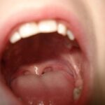 A child's mouth opened wide as if to say "ahhhh" for the doctor.